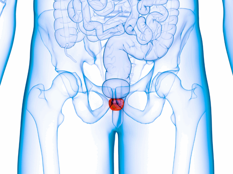 Antes do Holep, precisa fazer ressonância da próstata?