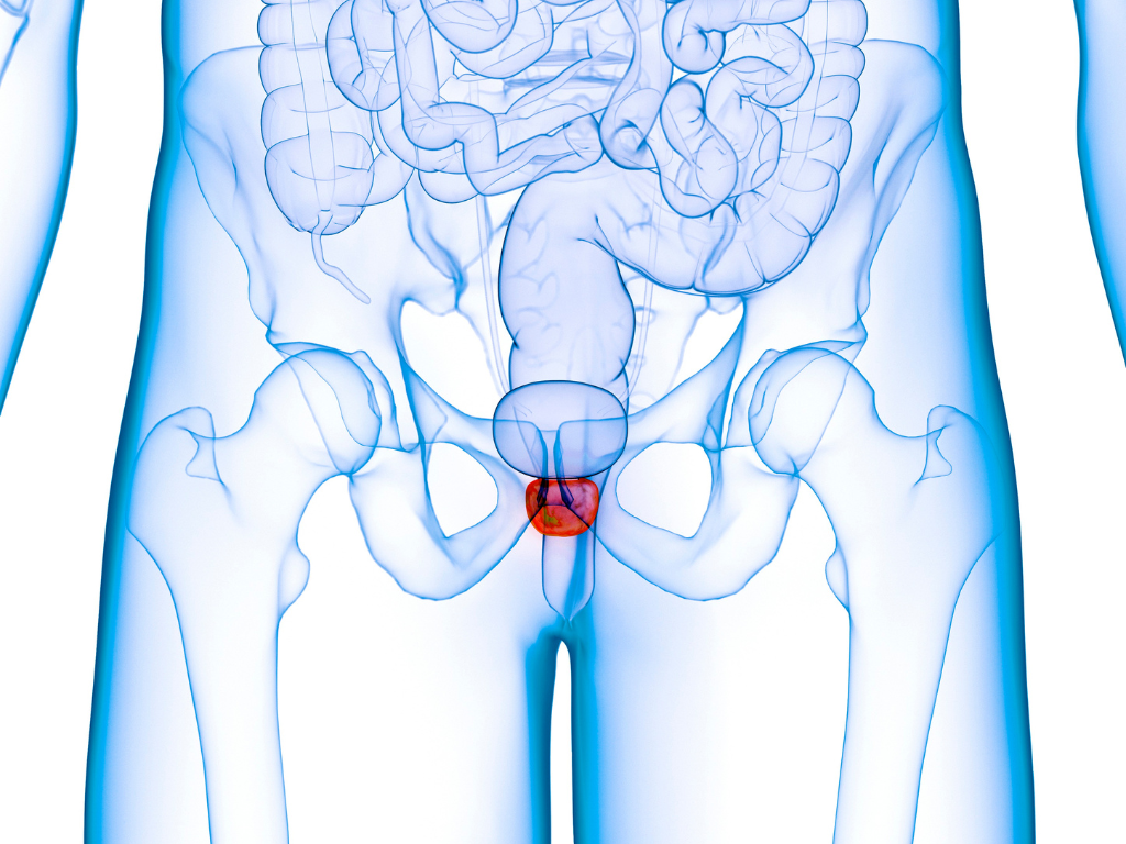 Antes do Holep, precisa fazer ressonância da próstata?