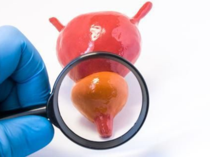 para que serve a próstata